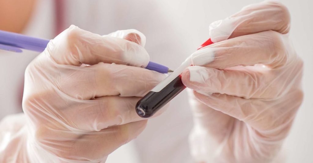 SGOT Full-Form- Definition, Uses, and Side Effects