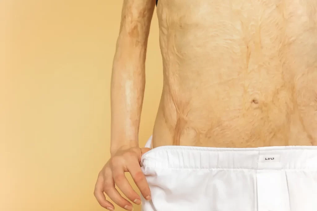 Outer Biosciences Living Tissue Platform Trains AI on Real Human Skin Outer Biosciences living tissue